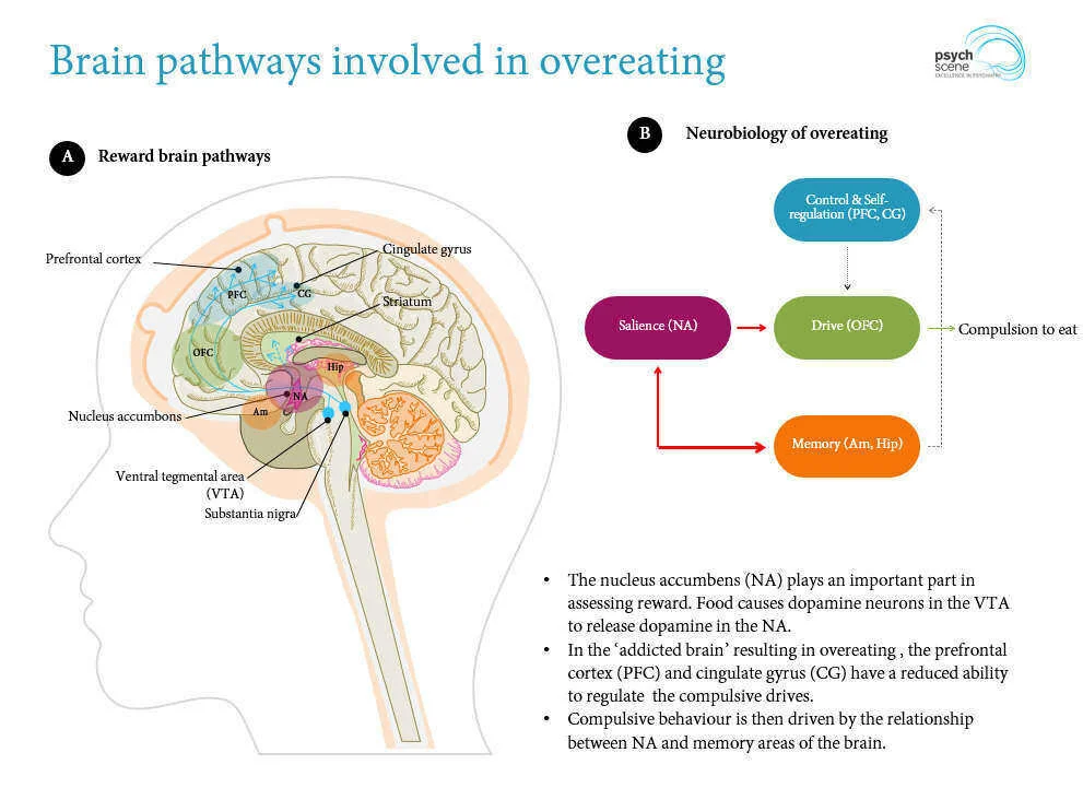 Neurobiology-of-overeating.jpg