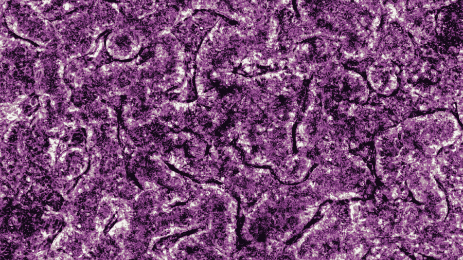 Intestine_Peristalsis.gif