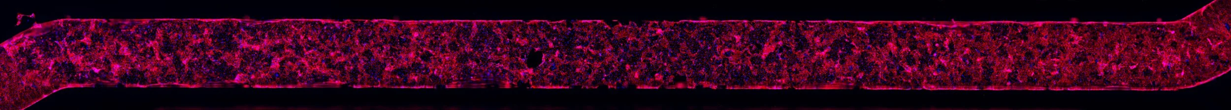 Human Intestinal Lining inside an Intestine-Chip