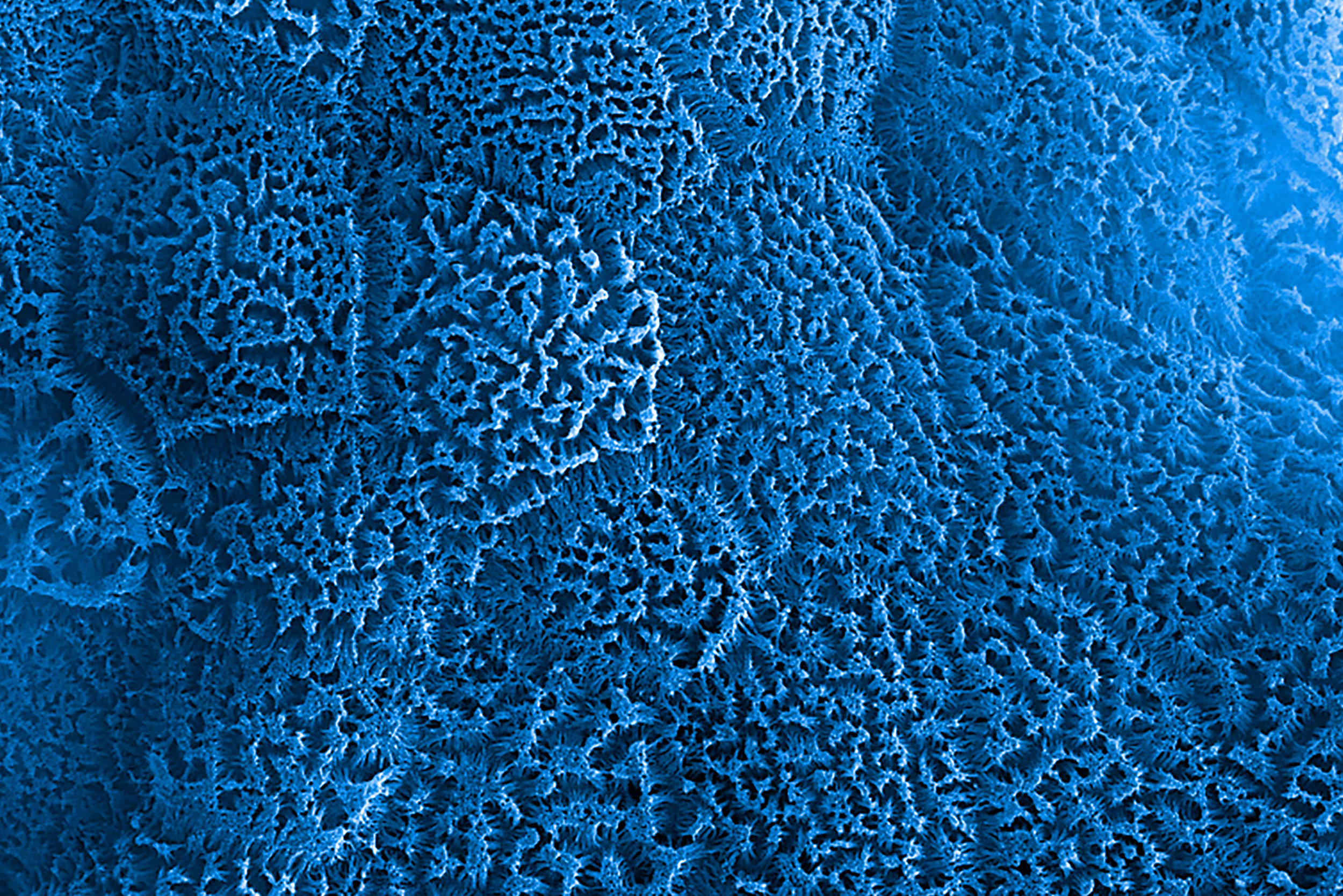 SEM image of intestinal microvilli in the Intestine-Chip.