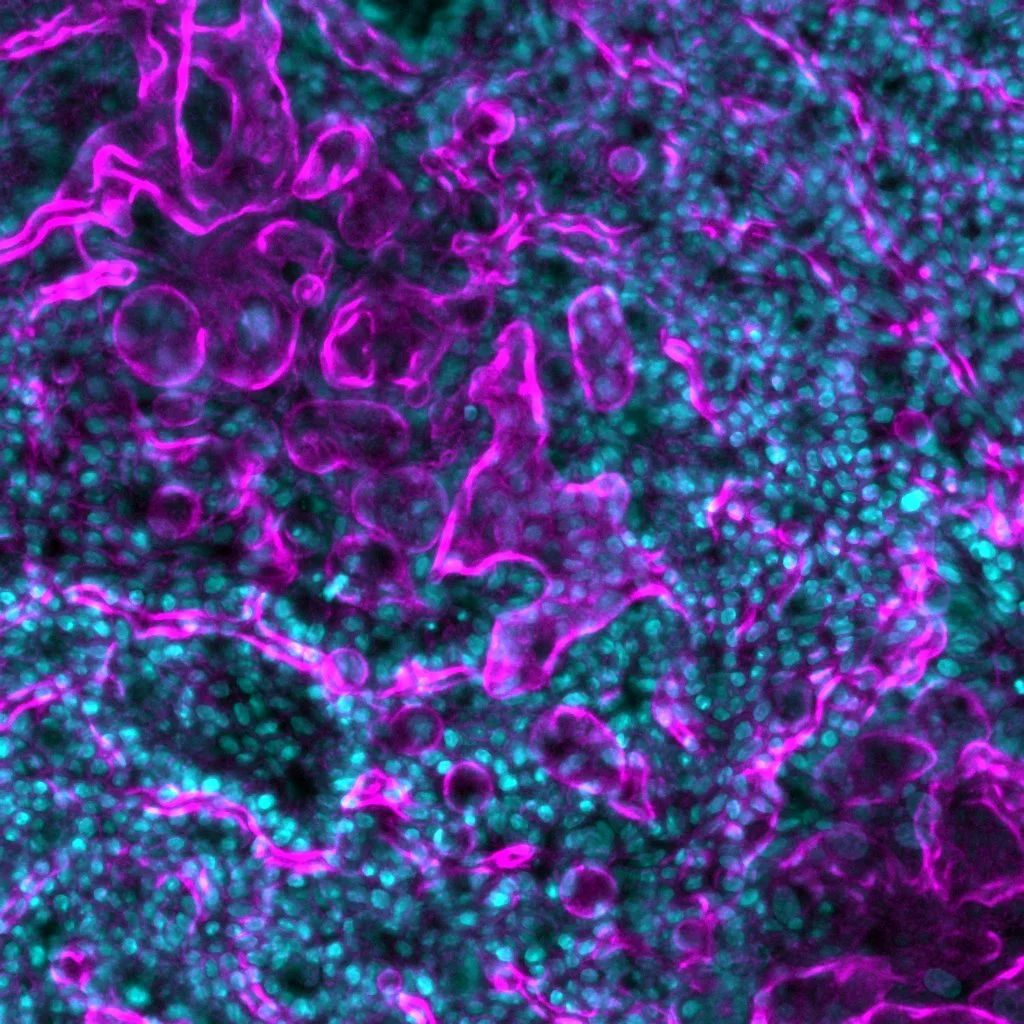 Image: Colonoids inside our Intestine-Chip. Day 5 in culture, stained F-actin (magenta) and nuclei (cyan)
