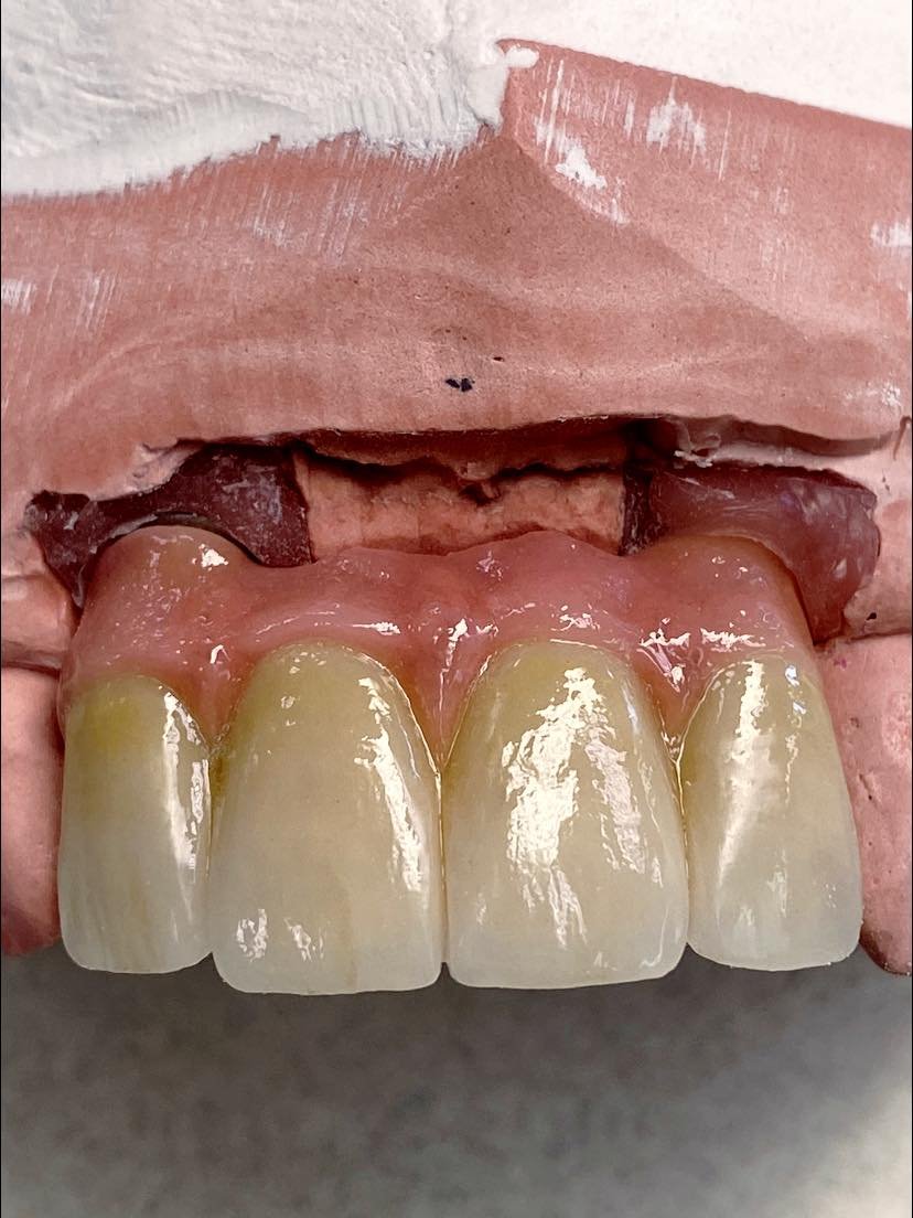 implant w pink.jpg