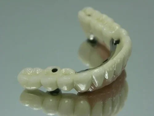 implants 2.jpg