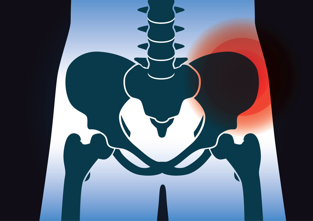 Pelvic Girdle Pain: What You Need to Know