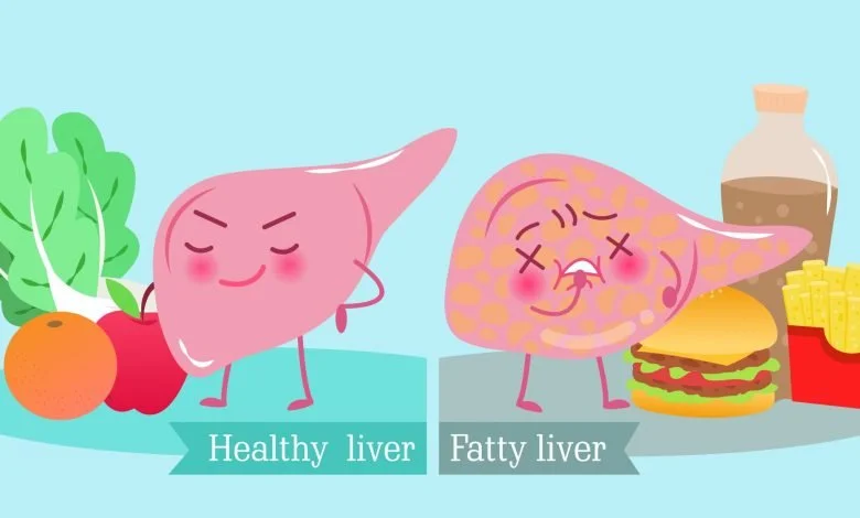 脂肪肝？ Fatty Liver??😼 😽