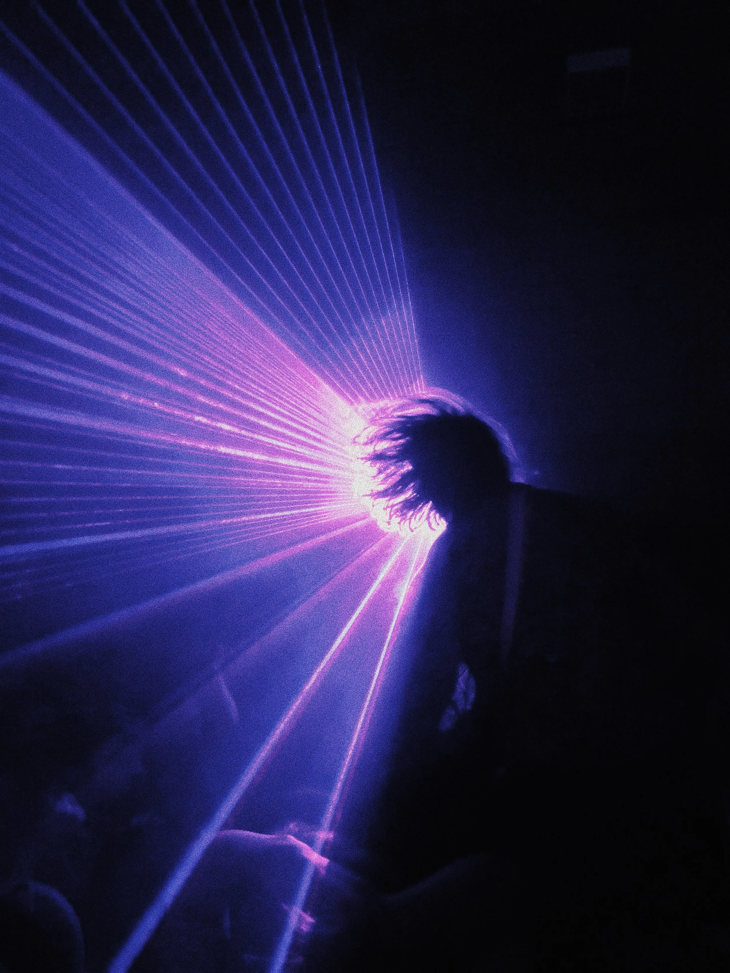 hair lazers.JPG
