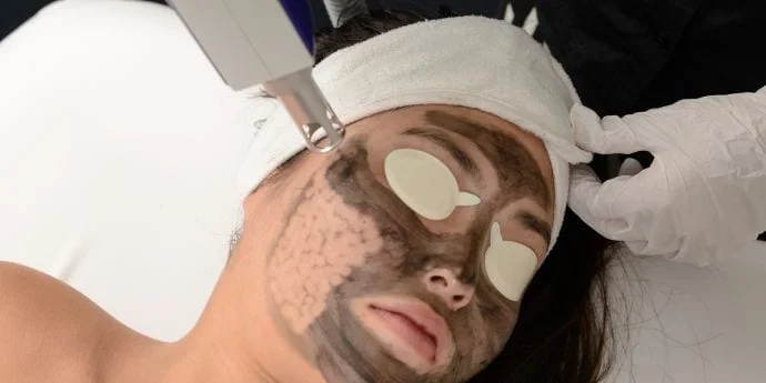 Carbon Laser Facials Ipl Photo Rejuvenation Replenish Skin Beauty