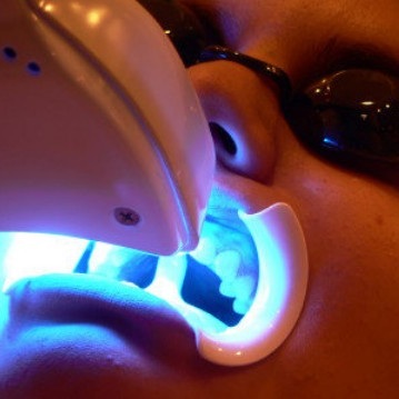 teeth whitening2.jpg