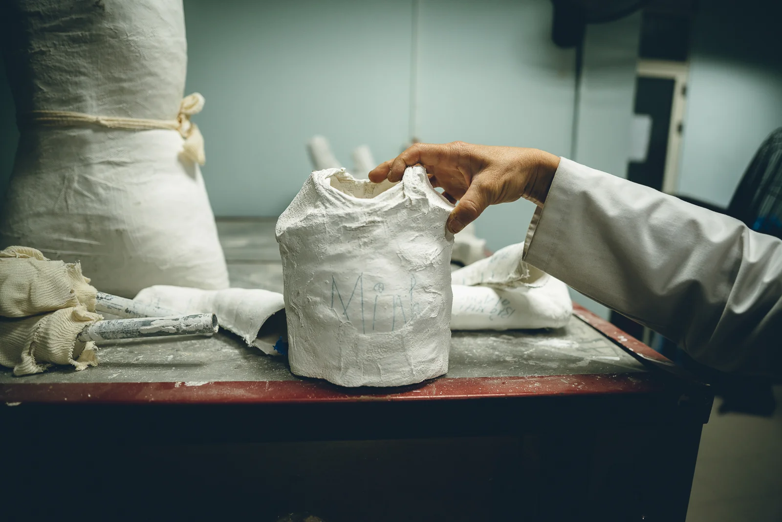 The VVMF’s rehabilitation program and established prosthesis workshops at the Vietnam National Children’s Hospital have been very successful over the years.
