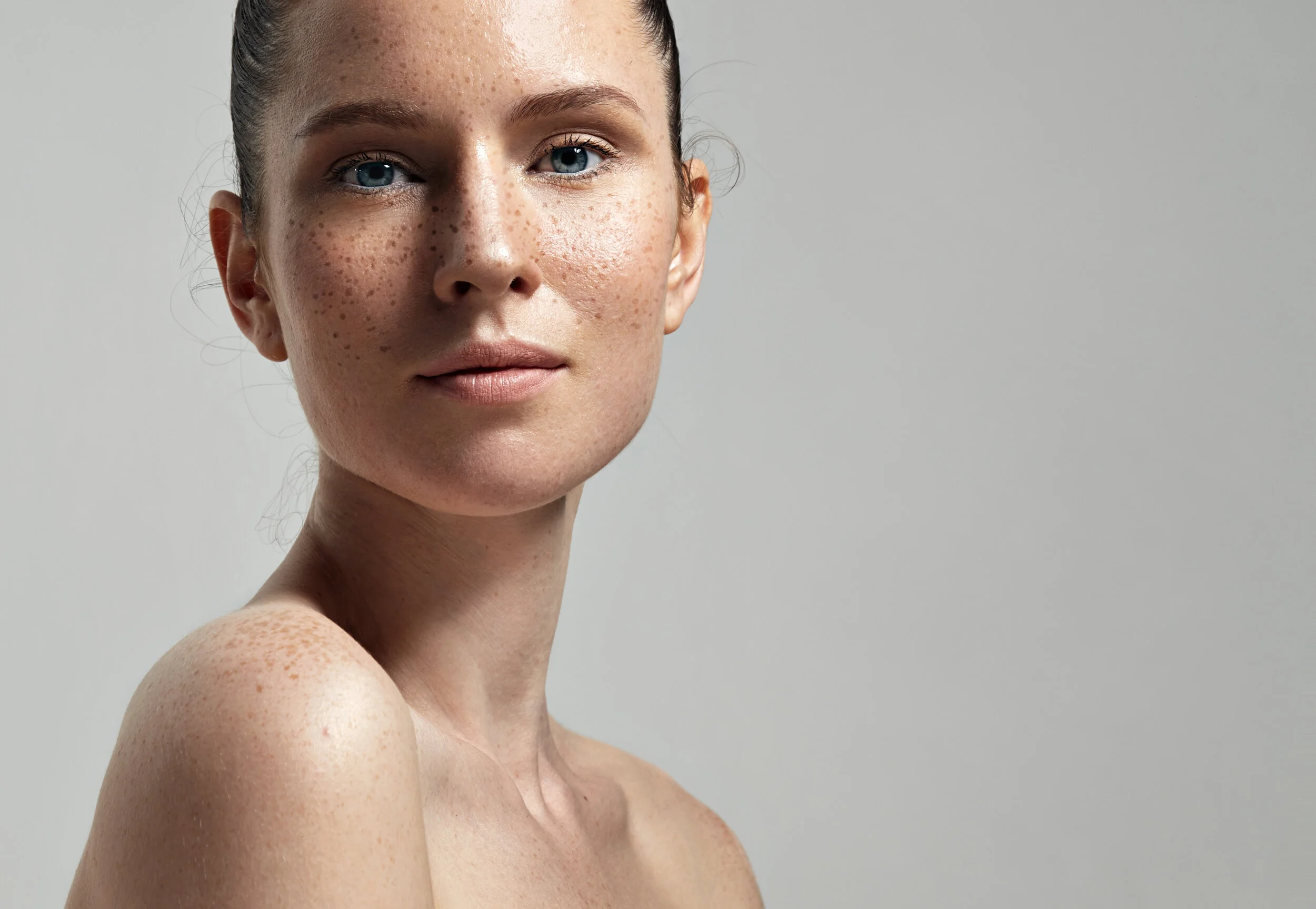 Venus IPL Photofacial