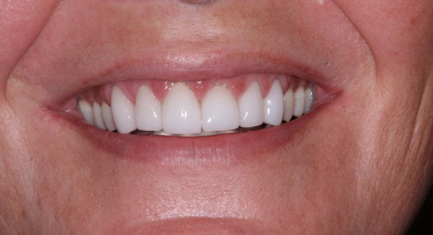 Teeth Repair Smile Gallery