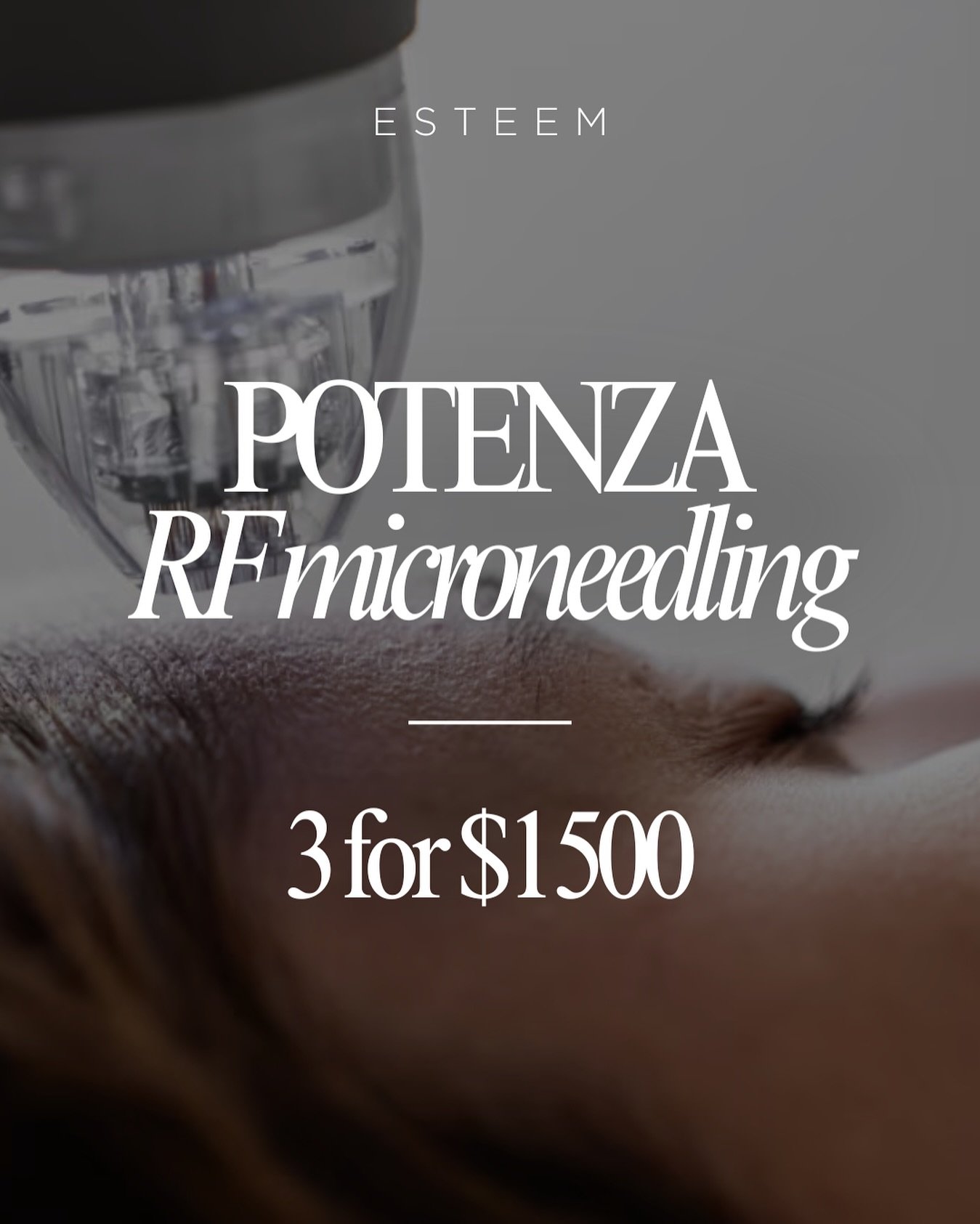 ⚡️POTENZA RF Microneedling &ndash; 3 sessions for $1500⚡️

If you&rsquo;re ready for smoother, tighter, clearer skin&hellip; potenza is your treatment!

Potenza uses ultrafine needles + radiofrequency energy to create controlled micro-injuries deep i