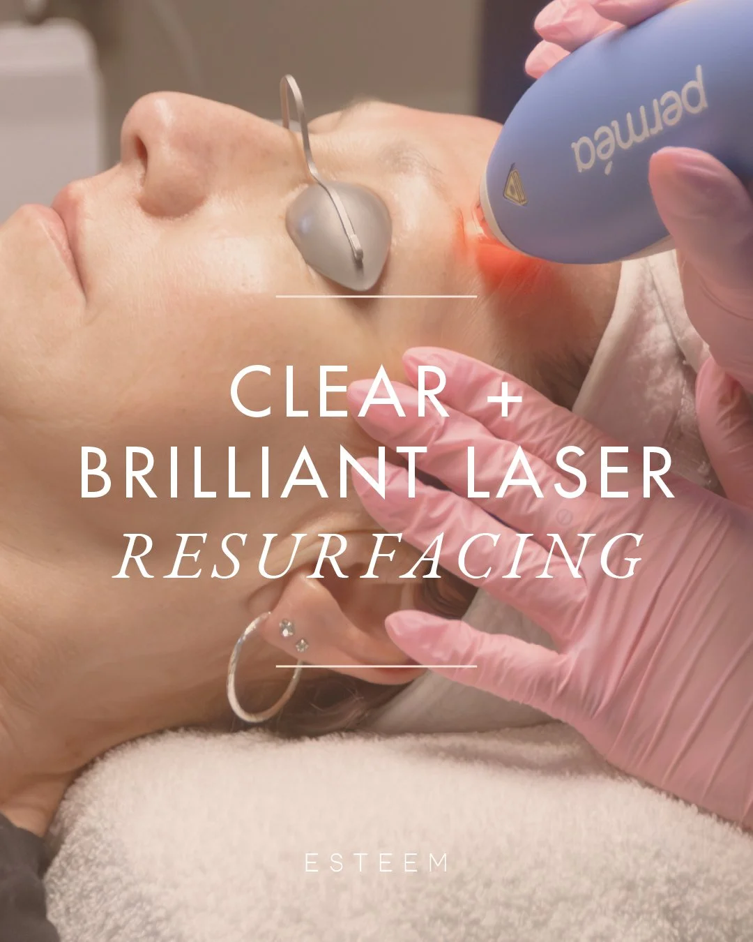 Clear + Brilliant laser resurfacing ✨
Looking to refresh your skin with minimal downtime? Clear + Brilliant&reg; is a gentle fractional
laser treatment designed to improve overall skin tone and texture while stimulating collagen
production.

This tre