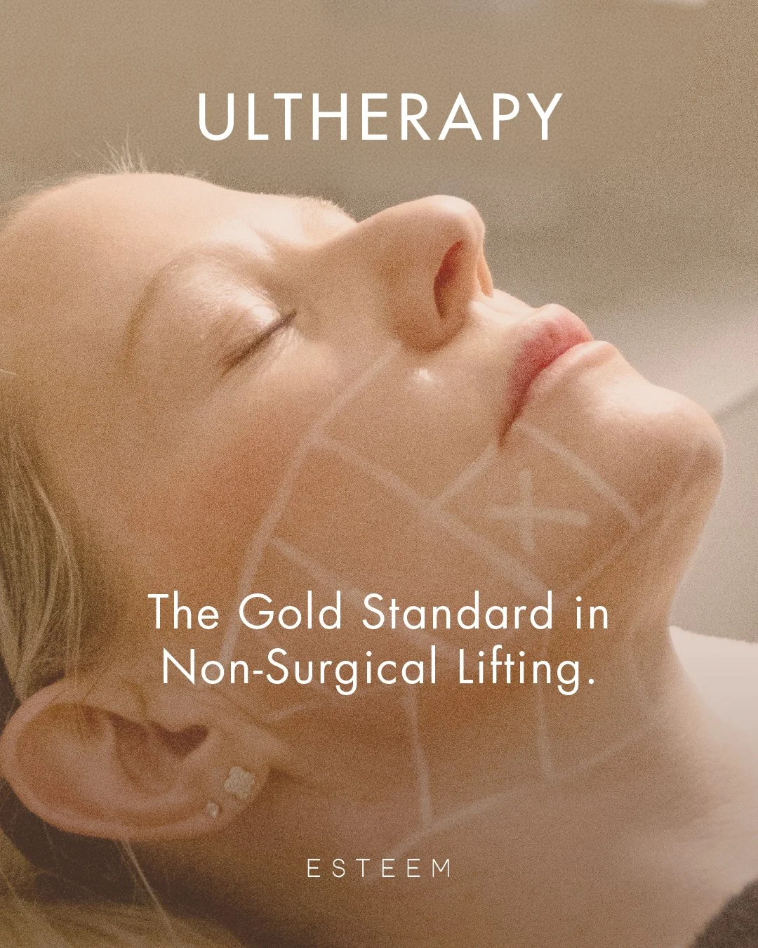 Ultherapy&reg; at Esteem Medical Esthetics uses ultrasound technology to reach the deep tissue layers typically only addressed in the operating room. By sparking fresh collagen production, it naturally lifts the skin on your neck, chin, and brow with