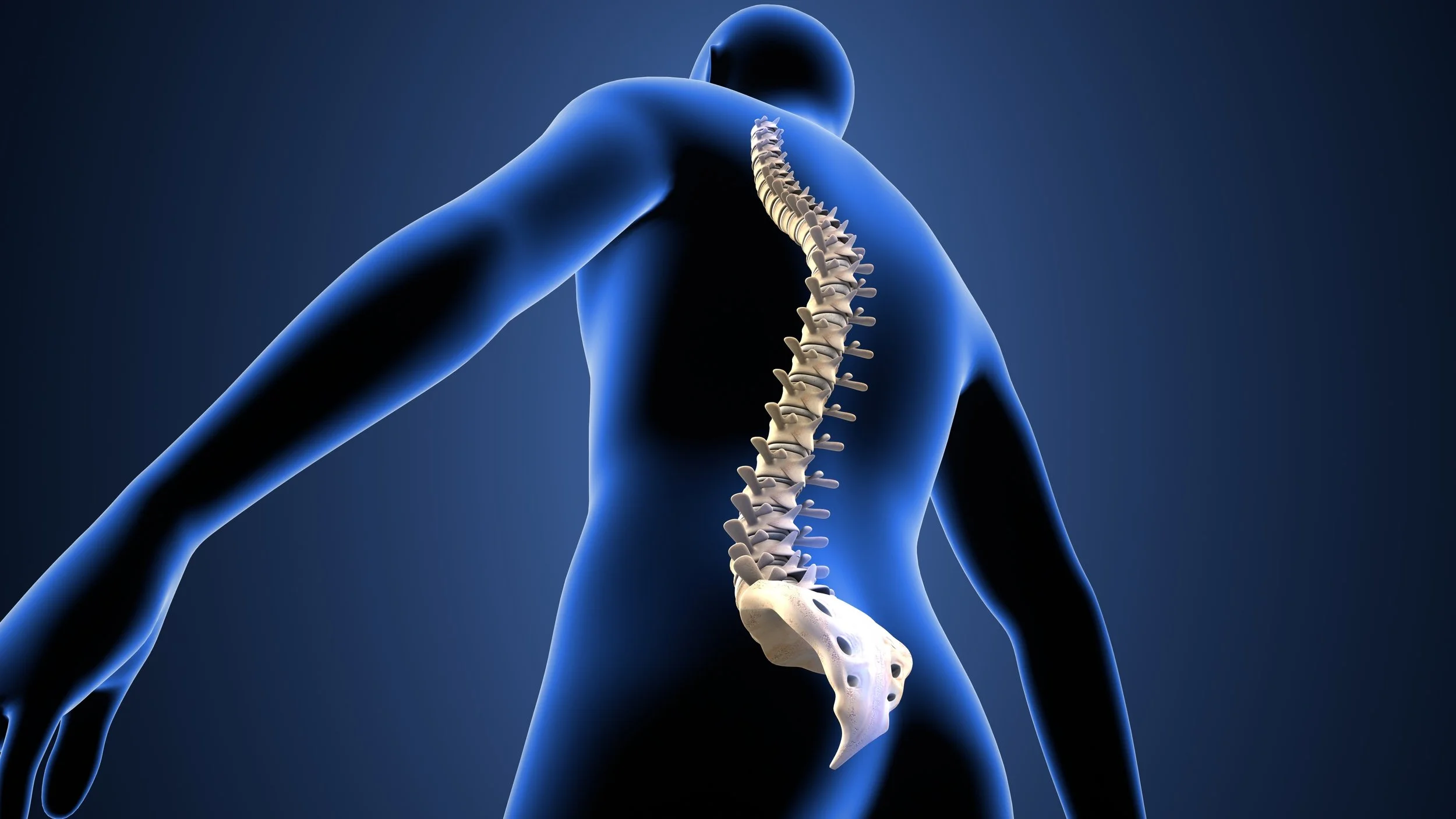 SIB#377- Formula for Ideal Lumbar Lordosis