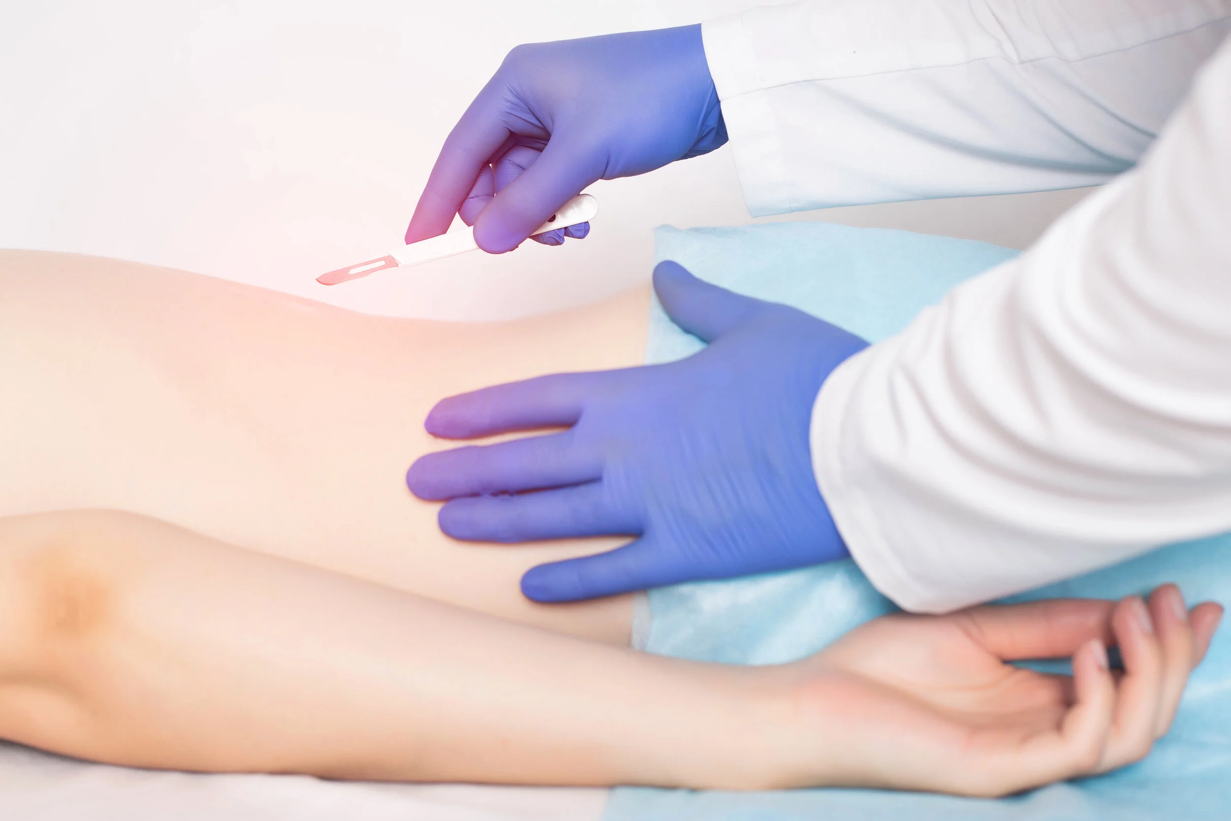 SIB# 394-Predicting Surgical Alignment Goals