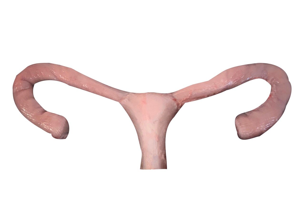 Gynecologic Surgery Specimens