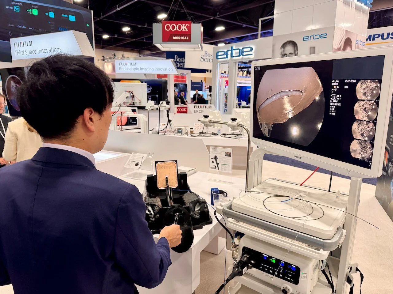 EASIE-R5 with EndoGel.jpeg