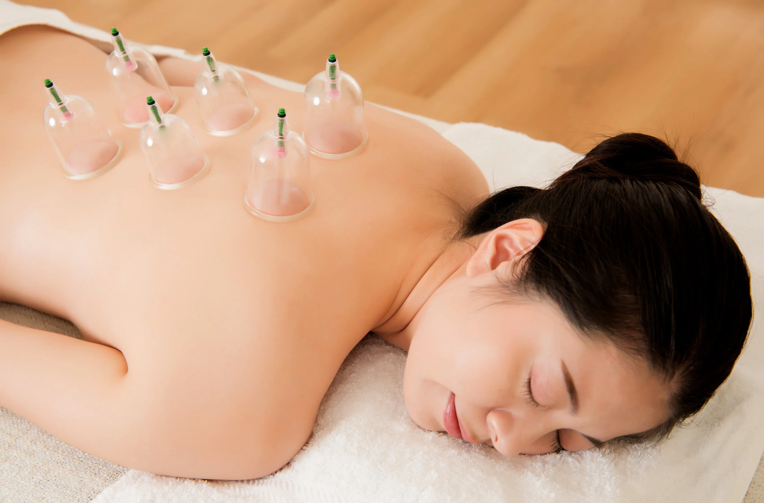 Southwind-Health-Collective-Cupping.jpg