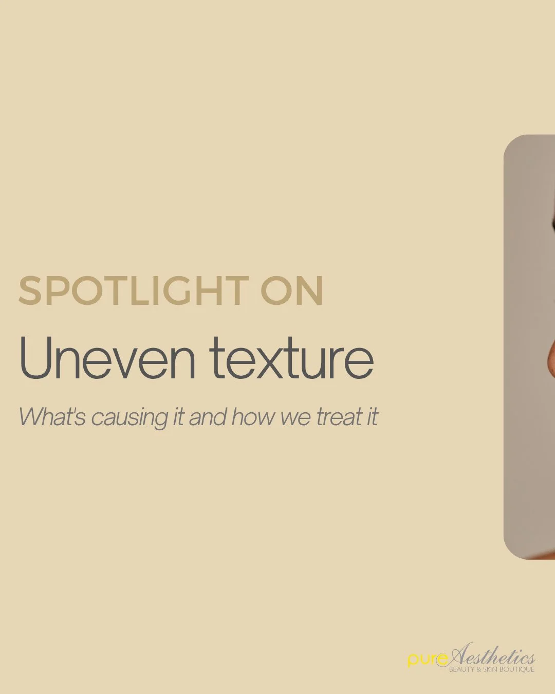 Uneven texture is one of the most common concerns we see, and one of the most responsive to the right treatment sequence. ✨⁠
⁠
It builds when dead skin cells accumulate, congestion sits beneath the surface or post-breakout scarring is left untreated.