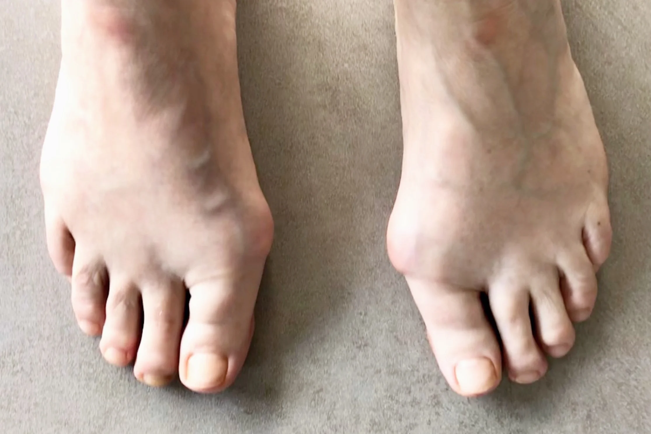 Case 10: Before surgery