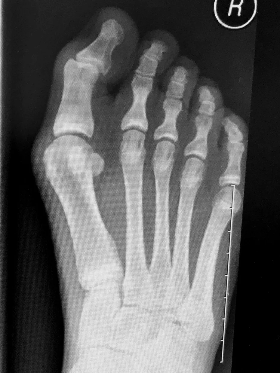 Case 11: Before Surgery
