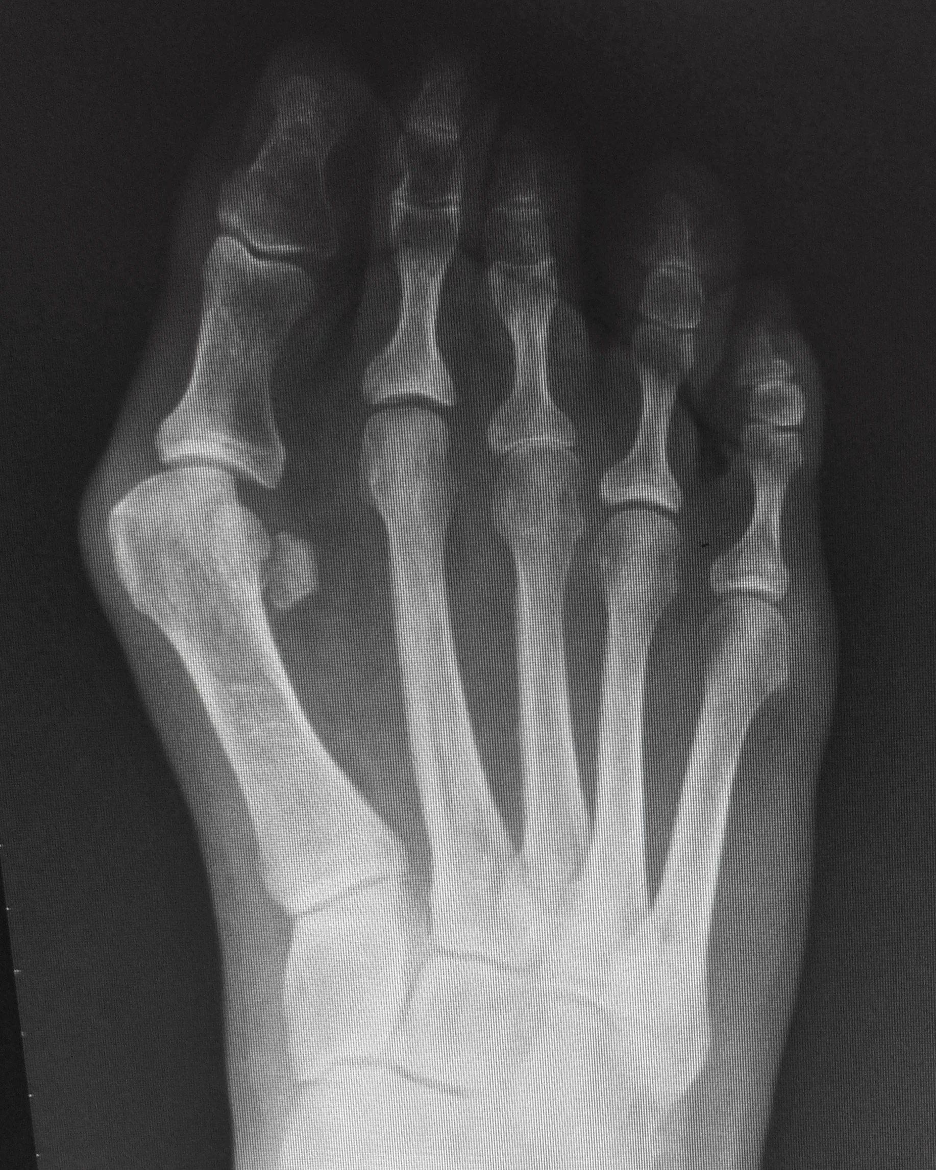 Case 9: Before surgery