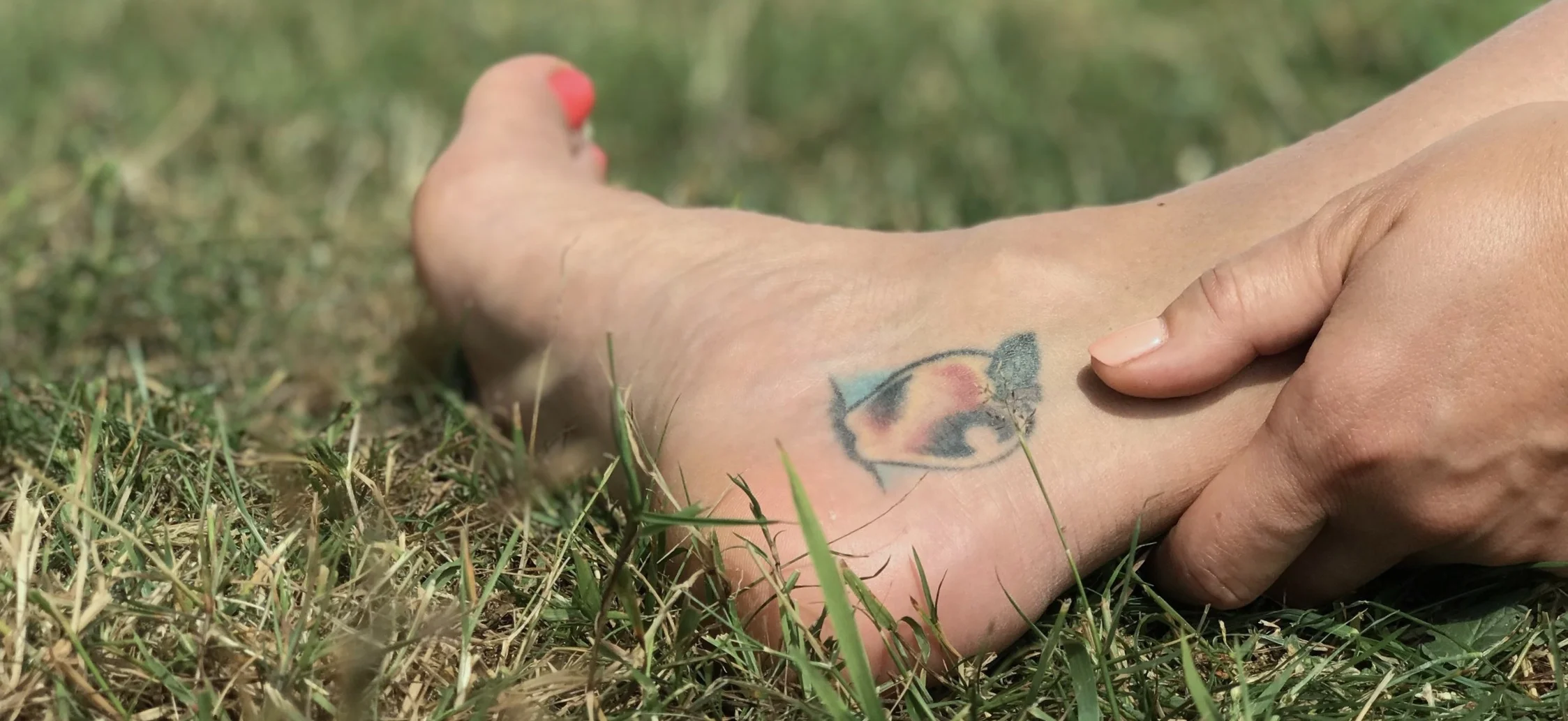 Mid-substance Achilles tendinitis (tendinopathy) produces pain in the area of the tendon shown here usually approximately 6-8 cm above the heel