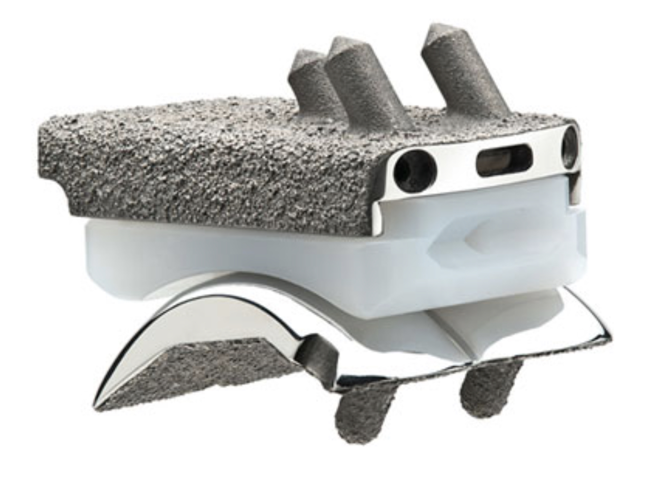 Infinity Total Ankle Replacement.jpg