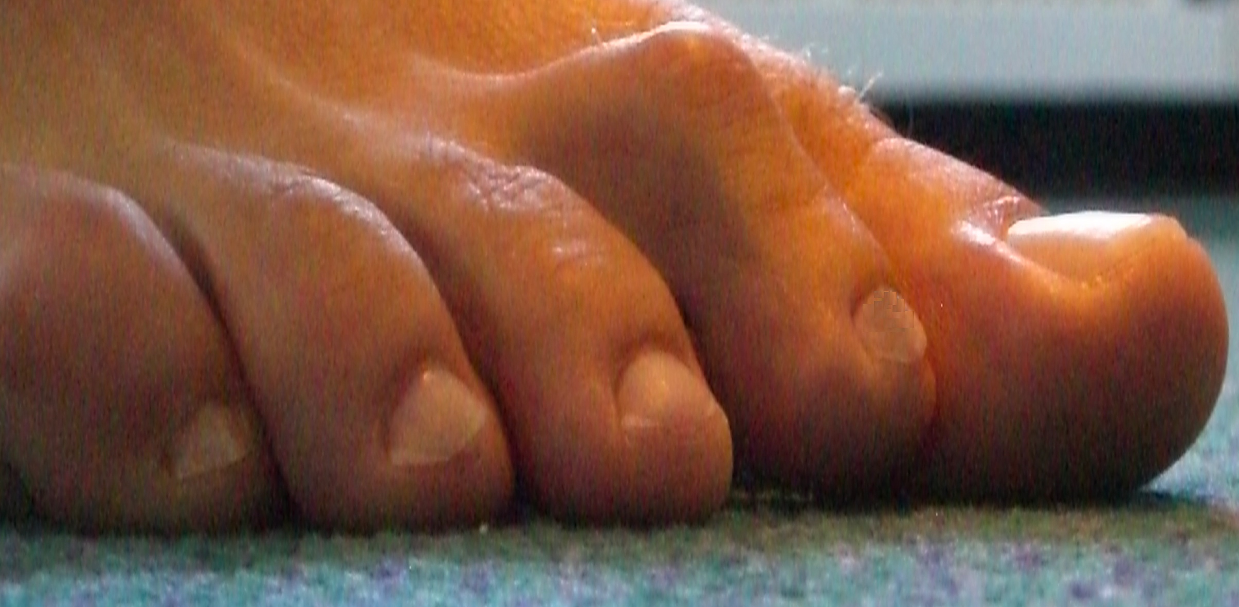 hammer+2nd+toe.jpg