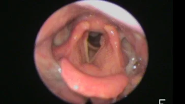 Picture1.jpg