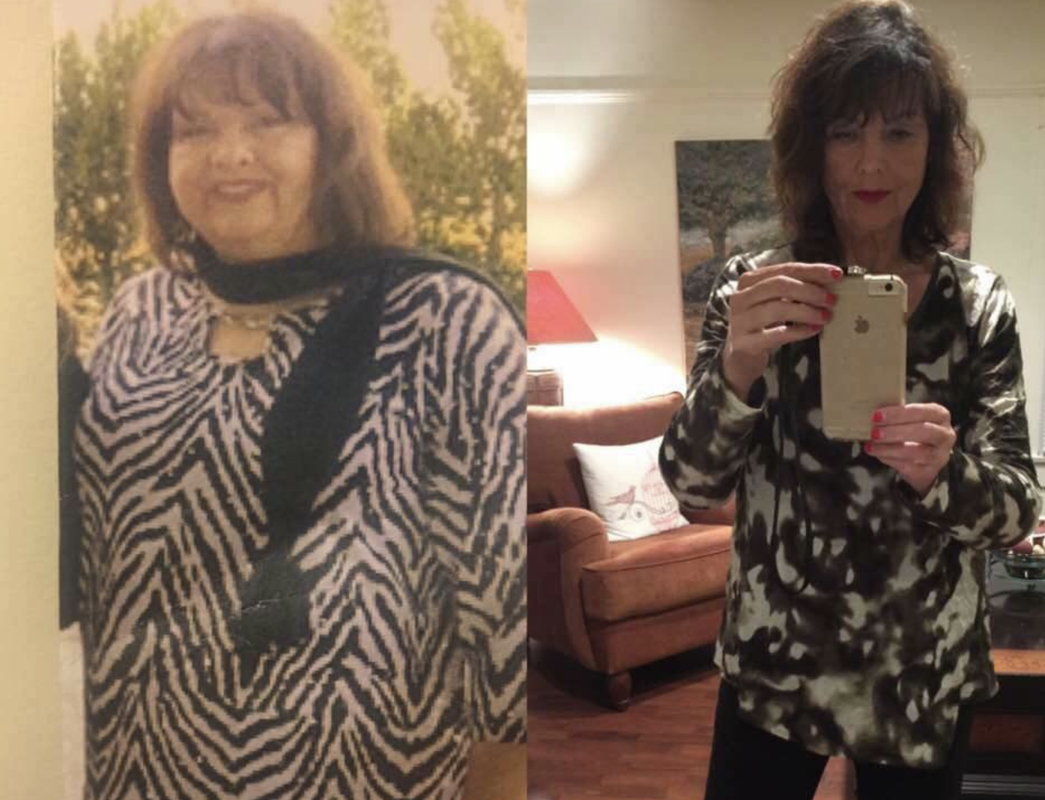 before n after hl 2.png