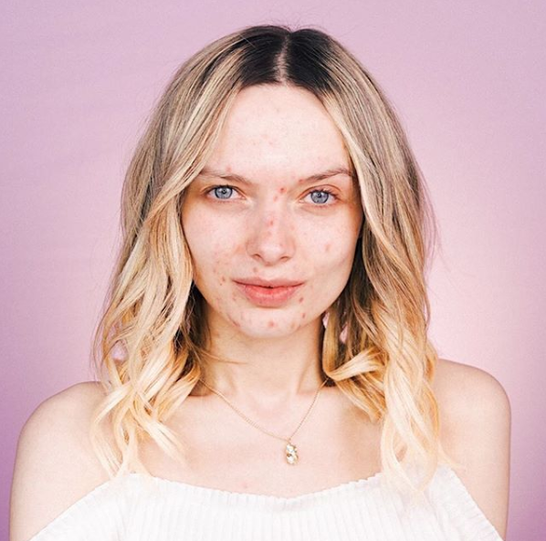 6. Em Ford - @mypaleskinblog - is serious makeup goals but shows us that she is so much more than makeup, and that airbrushed, peachy perfection is not real life. She wants you to “be a little more you, and a lot less them”. We likey.