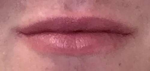 Lip after.jpg