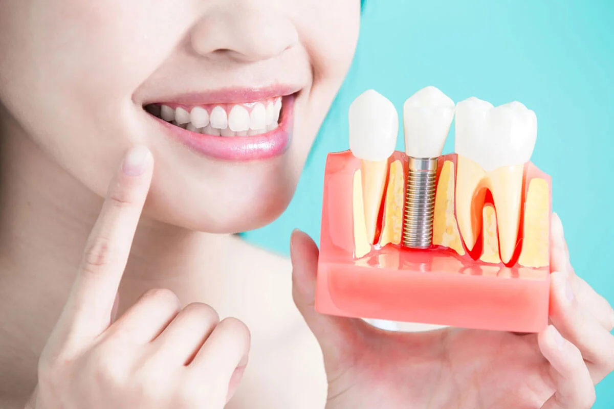dentalimplants-800-Oct2018.jpg