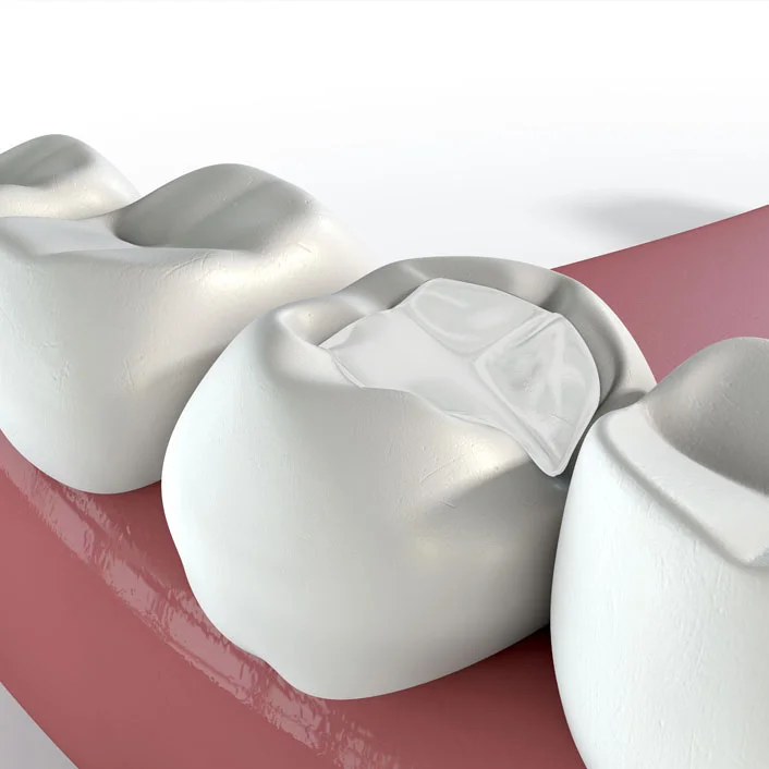 fillings-lg-1.jpg
