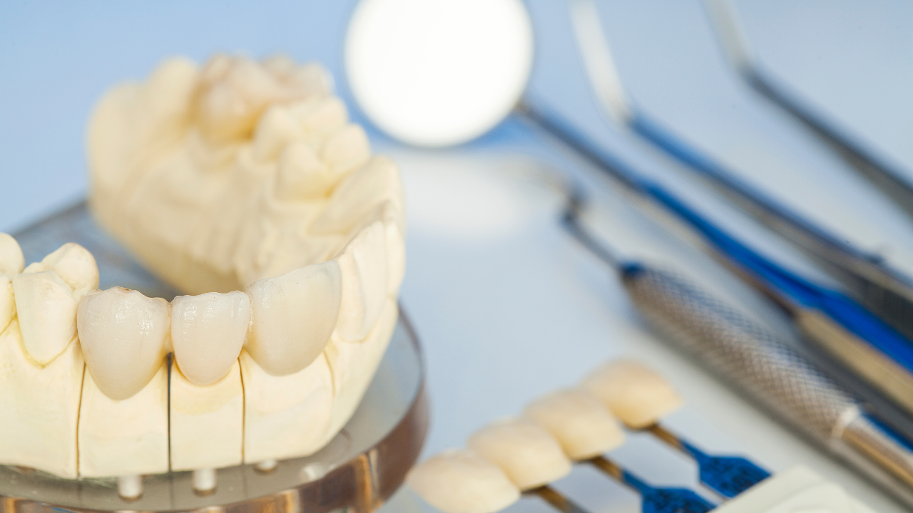 Porcelain Veneers at True Dental Care in Jersey City, NJ — True Dental Care