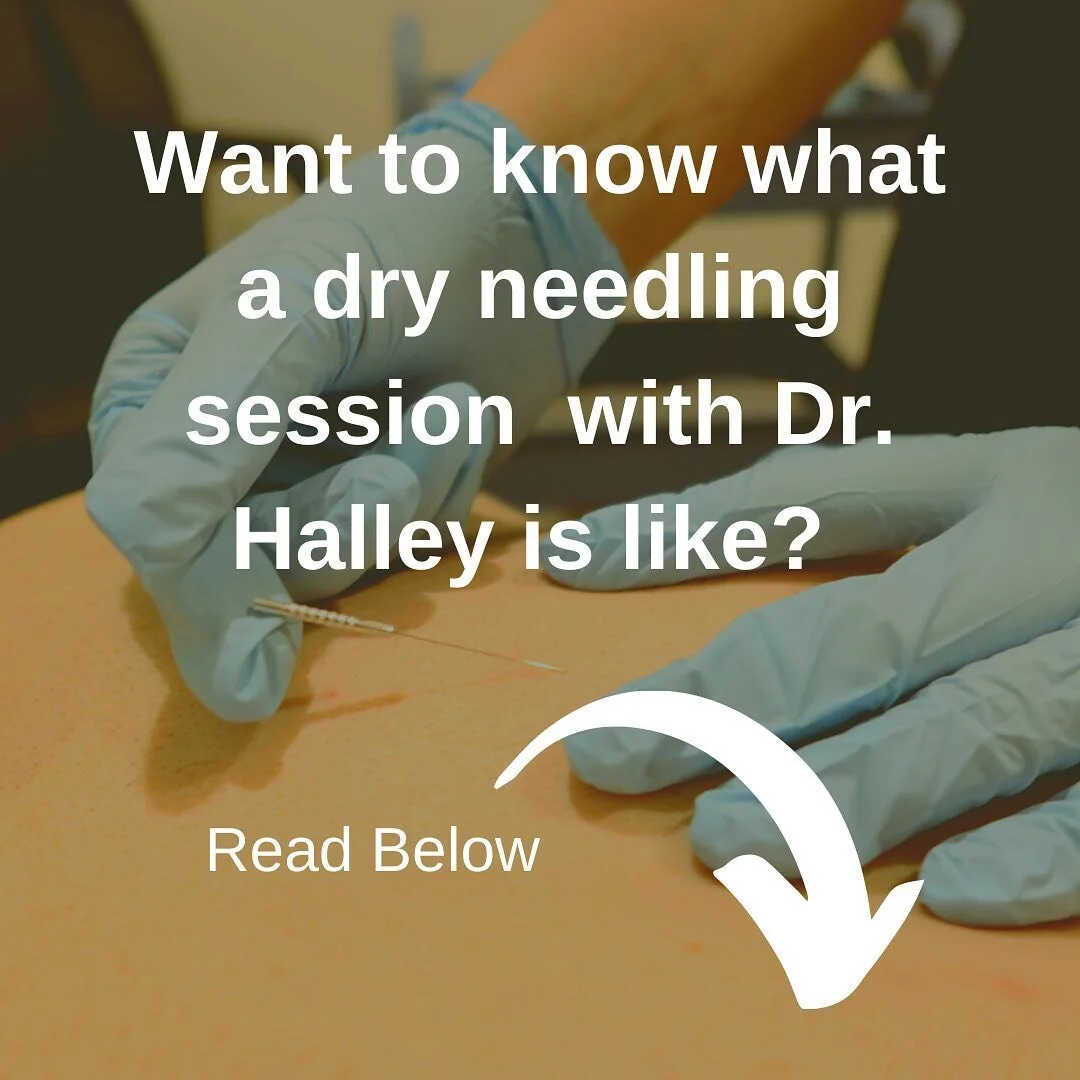 What does a typical dry needling session look like with @dr.ellynhalley?

 
We work together to determine the area that needs to be addressed through dry needling, and evaluate other areas of importance that may respond better to other methods of car