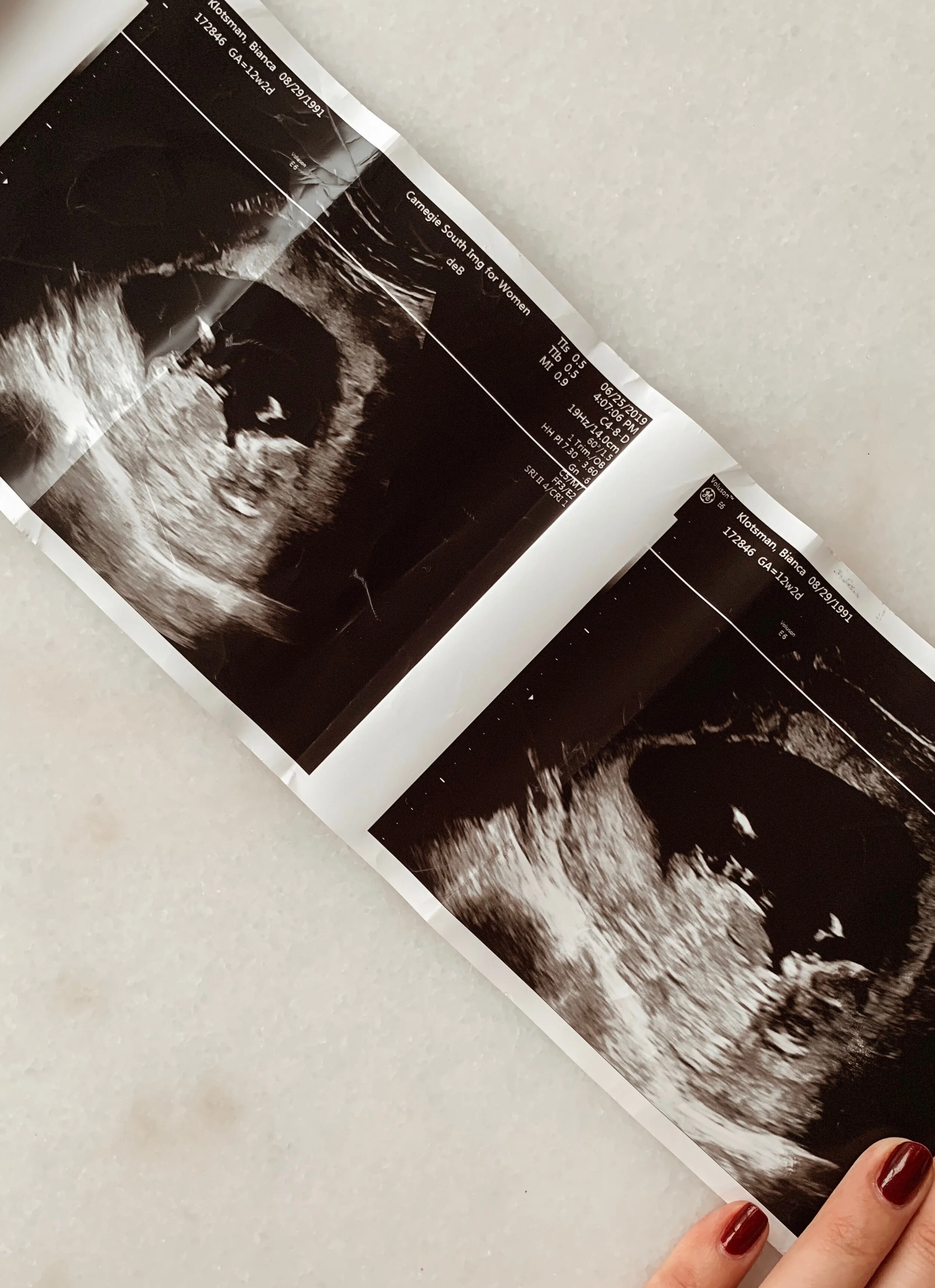 I’M PREGNANT!! + First Trimester Realness