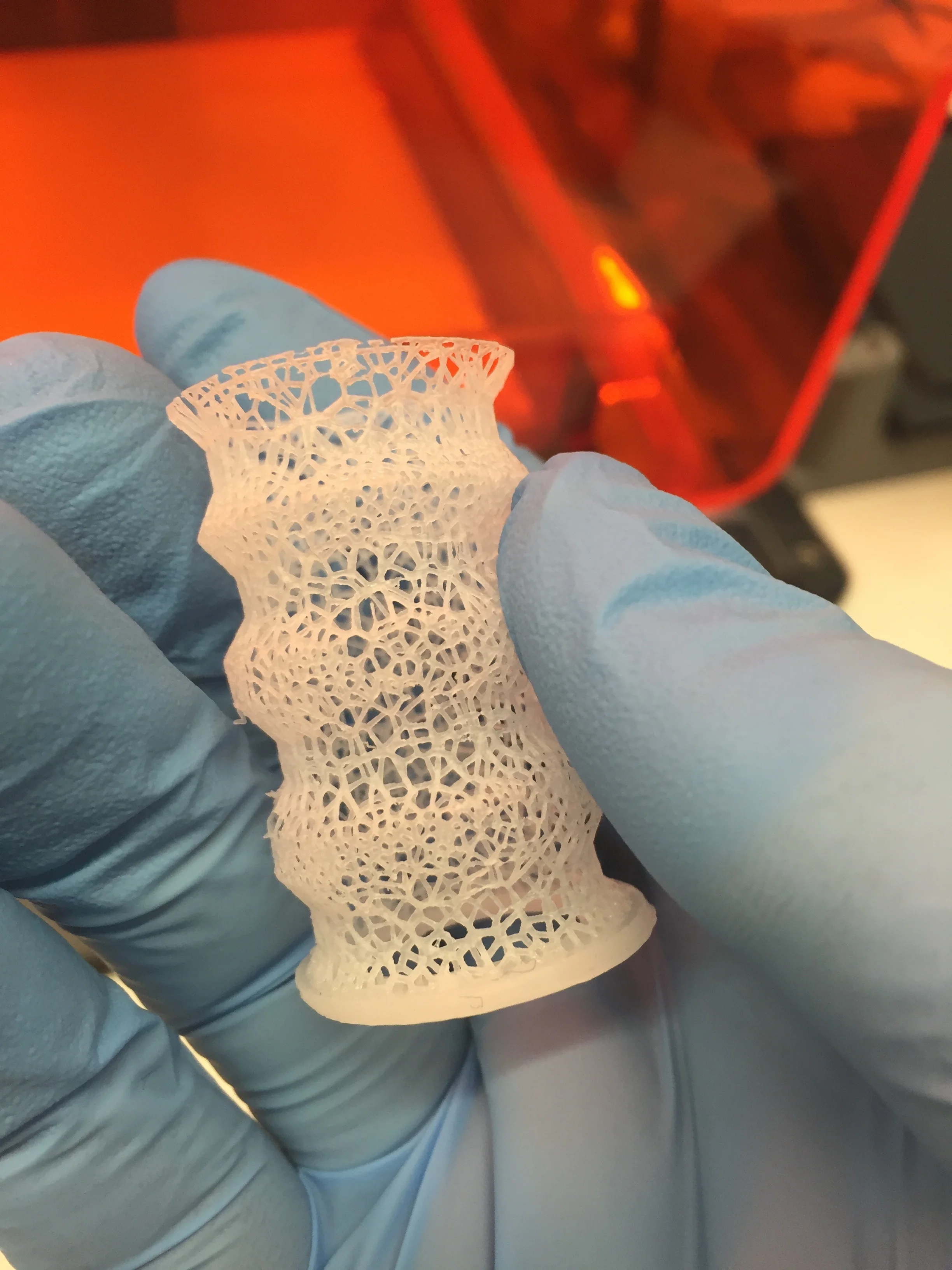 Tracheal Stent Scaffold