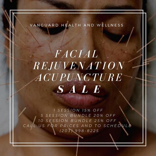 ACUPUNCTURE FACELIFT ⁠
⁠
Anyone out there interested in a completely natural way to reduce fine lines and wrinkles? ⁠
⁠
❗Facial rejuvenation acupuncture can increase collagen synthesis throughout the face, decreasing wrinkles over time with absolutel