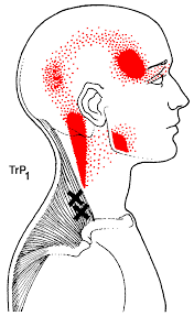 neck.png