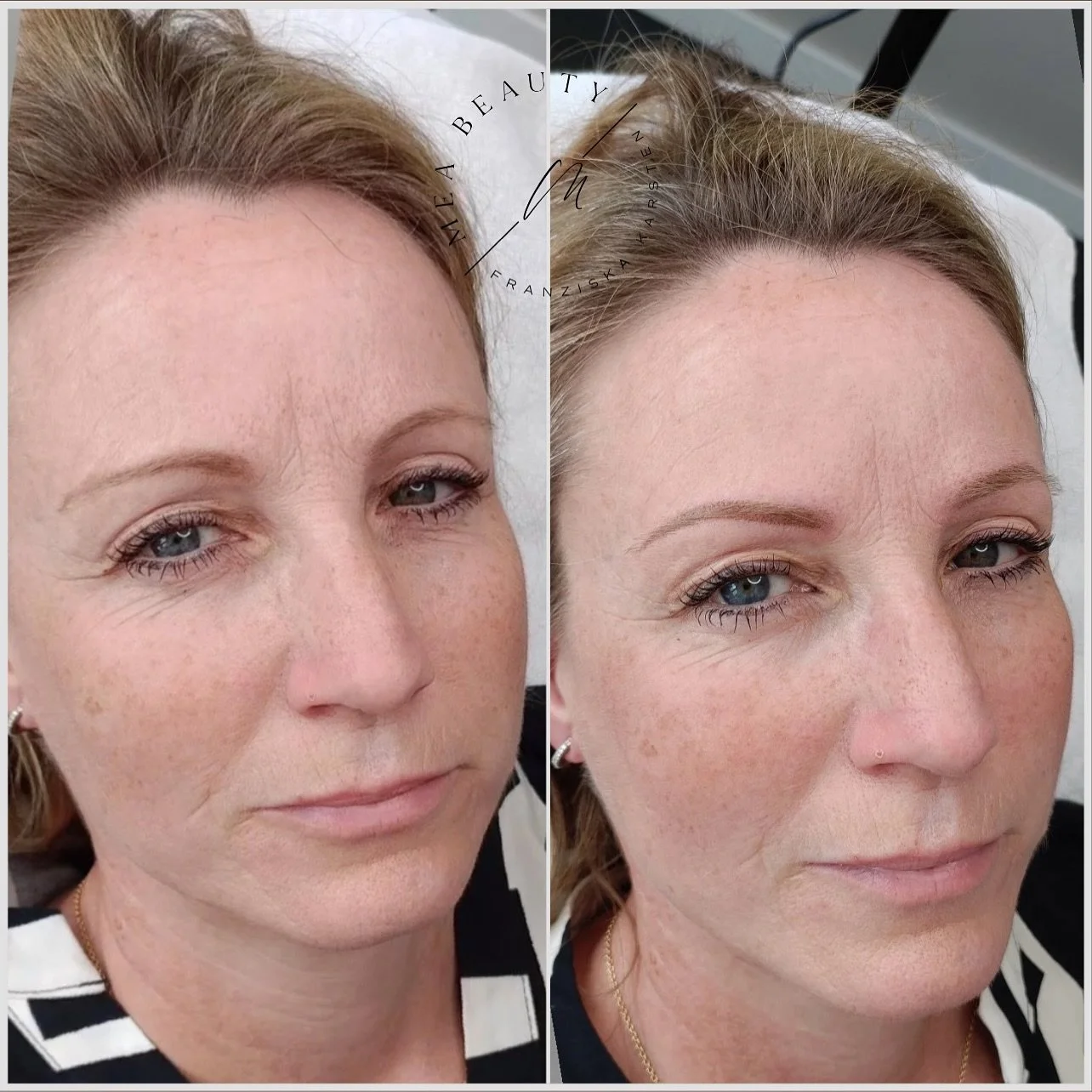 Wir k&ouml;nnen dich nicht j&uuml;nger zaubern, aber wir k&ouml;nnen dir mit Sicherheit dabei helfen, dass du dich wohl f&uuml;hlst mit einem frischeren Aussehen und zwar zu jeder Tageszeit und in jeder Situation. 

Denn Nat&uuml;rlichkeit steht bei 