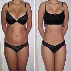 lipo cavitation benefits