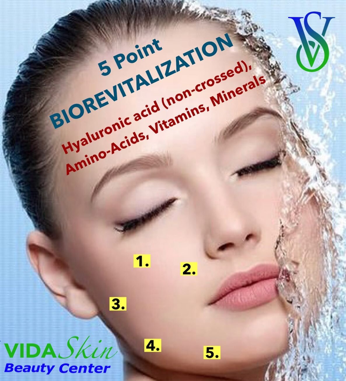 Biorevitalization - with 5 point Injections each side of face.
👇
MESOGOLD INCLUDES:
- Hyaluronic acid (non-crossed)
- 18 different Amino Acids
- 5 different Minerals
- 1 anti-aging peptide
- 1 Anti-oxidant
- Vitamin B2
👇
BENEFITS:
-Reduces wriknkle