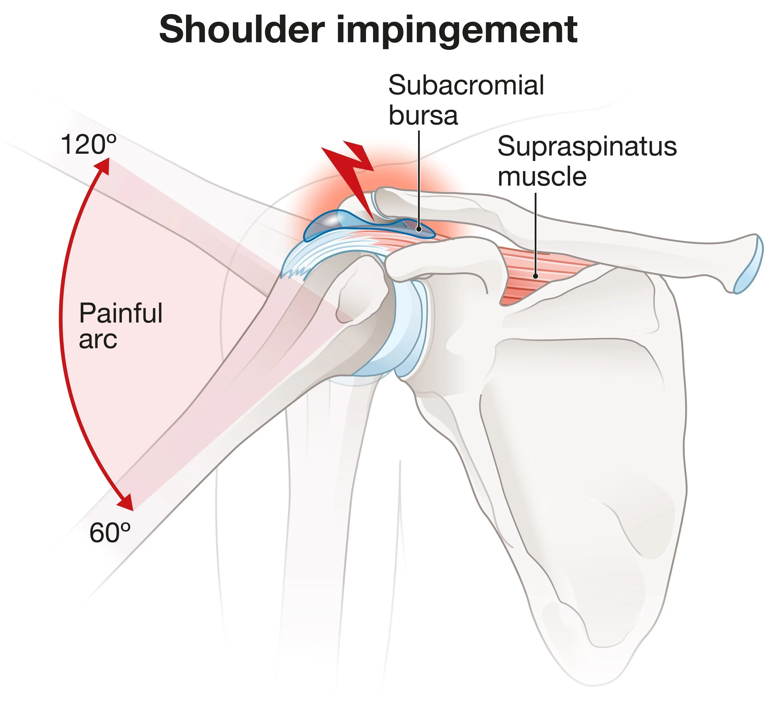 Shoulder Impingement Anatomy Shoulder Bursitis Scan Shoulder