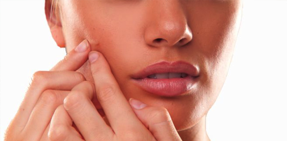 ACNE-Facial.jpg