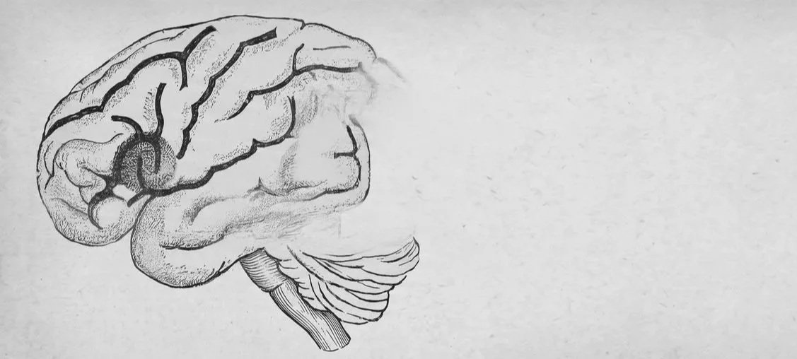 brain aphasia.jpg