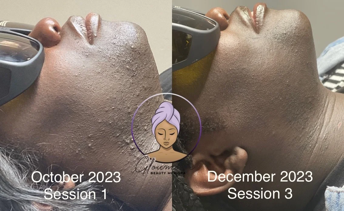 9 Best Ways to Remove Hair 