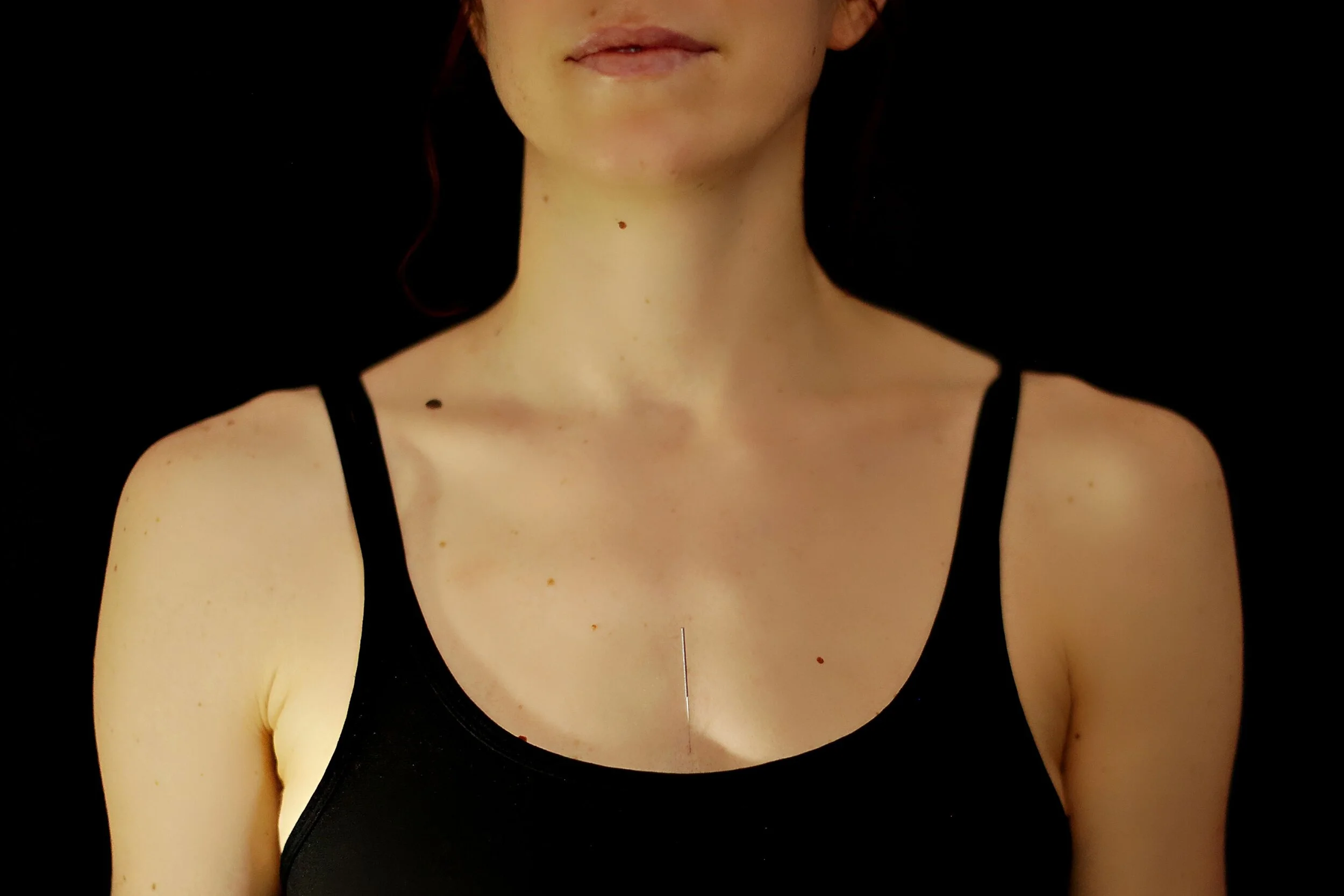 What Is Acupuncture &amp; How Can It Help You?